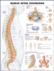 Human Spine Disorders Anatomical Chart - Book