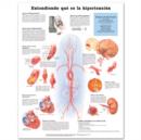 Understanding Hypertension Anatomical Chart in Spanish (Entendiendo Que Es La Hypertension) - Book
