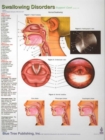 Swallowing Disorders - Book