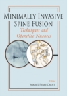 Minimally Invasive Spine Fusion: Techniques and Operative Nuances - Book