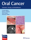 Oral Cancer : Evaluation, Therapy, and Rehabilitation - Book