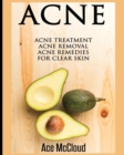 Acne : Acne Treatment: Acne Removal: Acne Remedies for Clear Skin - Book