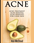 Acne : Acne Treatment: Acne Removal: Acne Remedies for Clear Skin - Book