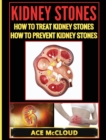 Kidney Stones : How to Treat Kidney Stones: How to Prevent Kidney Stones - Book