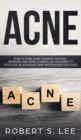 Acne : How to Cure Acne through Natural Remedies and Simple Habits. Say Goodbye to Pustules, Blackheads and Whiteheads for Good! - Book