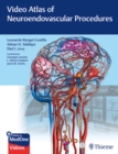 Video Atlas of Neuroendovascular Procedures - Book