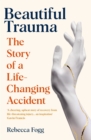 Beautiful Trauma : A Journey of Discovery in Science and Healing - eBook