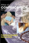 Atlas of Contraception - Book
