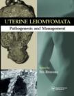 Uterine Leiomyomas : Pathogenesis and Management - Book
