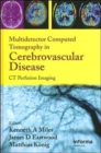 Multidetector Computed Tomography in Cerebrovascular Disease : CT Perfusion Imaging - Book