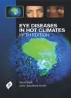 Eye Diseases in Hot Climates - Book