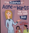 The Science of Acne & Warts : The Itchy Truth About Skin - Book