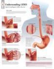 Understanding GERD (Gastroesophageal Reflux Disease) Paper Poster - Book