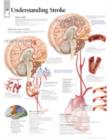 Understanding Stroke Paper Poster - Book