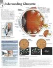 Understanding Glaucoma Paper Poster - Book