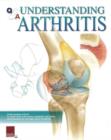 Understanding Arthritis Flip Chart - Book