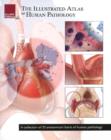 Illustrated Atlas of Human Pathology : A Collection of 25 Anatomical Charts of Human Pathology - Book