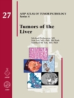 Tumors of the Liver - Book