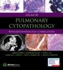 Atlas of Pulmonary Cytopathology - Book