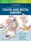 Cleveland Clinic Illustrated Tips and Tricks in Colon and Rectal Surgery - Book