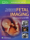 Fundamental and Advanced Fetal Imaging Ultrasound and MRI - Book