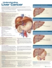 Understanding Liver Cancer Anatomical Chart - Book