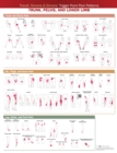 Travell, Simons & Simons’ Trigger Point Pain Patterns Wall Chart : Trunk, Pelvis, and Lower Limb - Book