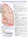 Understanding Lung Cancer Anatomical Chart - Book
