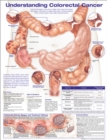 Understanding Colorectal  Cancer Anatomical Chart - Book