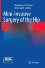 Mini-Invasive Surgery of the Hip - Book