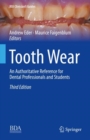 Tooth Wear : An Authoritative Reference for Dental Professionals and Students - Book