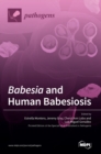 Babesia and Human Babesiosis - Book