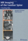 MR-Imaging of the Lumbar Spine : A Teaching Atlas - Book