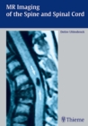 MR Imaging of the Spine and Spinal Cord - Book