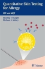 Quantitative Skin Testing for Allergy : IDT and MQT - Book
