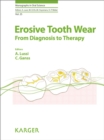 Erosive Tooth Wear : From Diagnosis to Therapy. - eBook