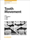 Tooth Movement - eBook