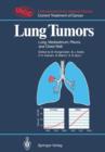 Lung Tumors : Lung, Mediastinum, Pleura, and Chest Wall - Book