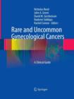 Rare and Uncommon Gynecological Cancers : A Clinical Guide - Book