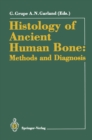 Histology of Ancient Human Bone: Methods and Diagnosis : Proceedings of the "Palaeohistology Workshop" held from 3-5 October 1990 at Gottingen - eBook