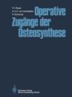 Operative Zugange Der Osteosynthese - Book