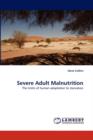 Severe Adult Malnutrition - Book