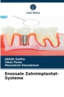 Enossale Zahnimplantat-Systeme - Book