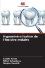 Hypomineralisation de l'incisive molaire - Book