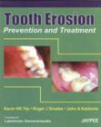 Tooth Erosion Prevention and Treatment - Book