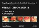 Single Surgical Procedures in Obstetrics and Gynaecology - Volume 15 - UTERUS - DISPLACEMENTS : A Colour Atlas of Cervicopexy (Purandare’s) - Book
