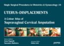 Single Surgical Procedures in Obstetrics and Gynaecology - Volume 16 - UTERUS - DISPLACEMENTS : A Colour Atlas of Supravaginal Cervical Amputation (Nadkarni's) - Book
