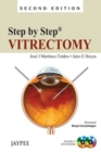 Step by Step: Vitrectomy - Book