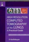 High Resolution Computed Tomography of the Lungs: A Practical Guide - Book