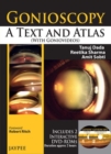 Gonioscopy: A Text and Atlas (with Goniovideos) - Book